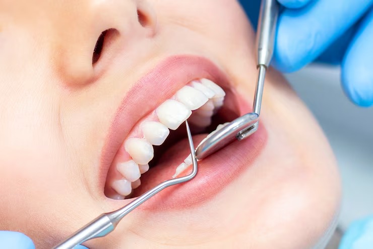 Best Dentist in Thane