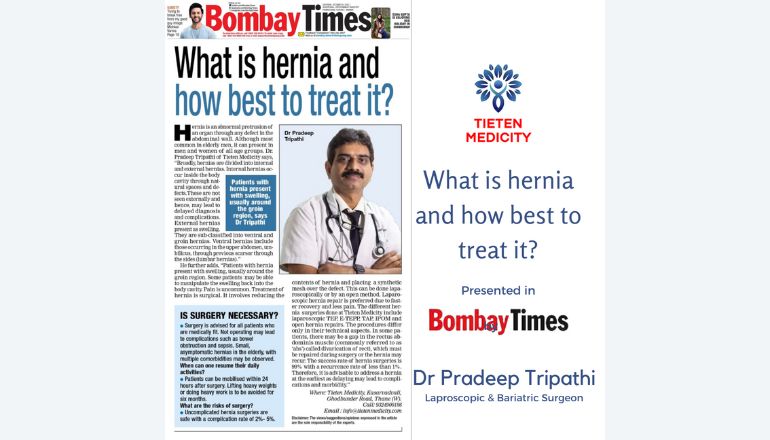 What is hernia and how best to treat it?