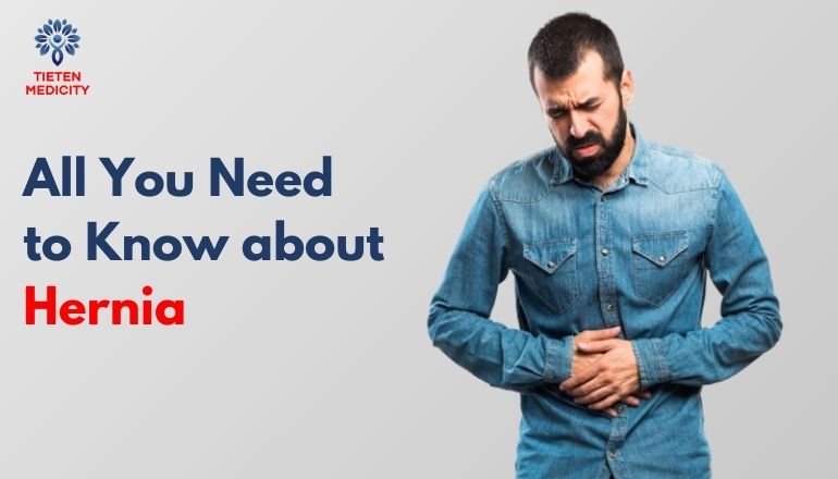 All You Need to Know about Hernia