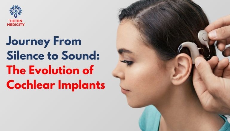 Journey From Silence to Sound: The Evolution of Cochlear Implants