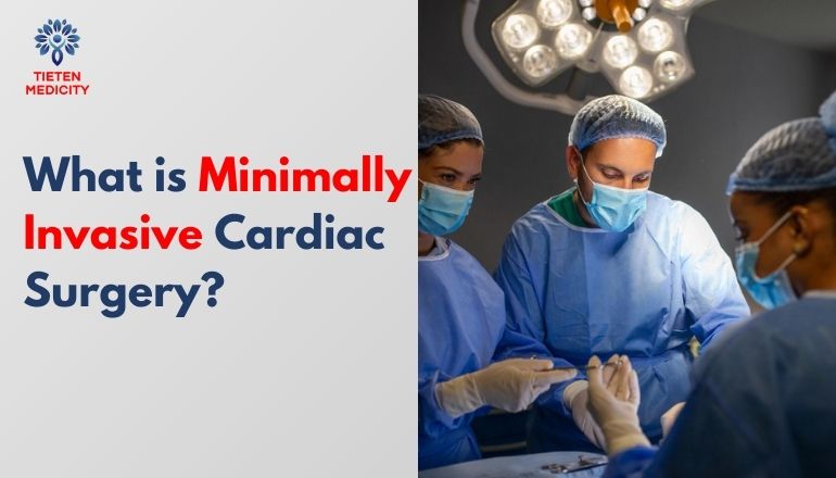 What is Minimally Invasive Cardiac Surgery?