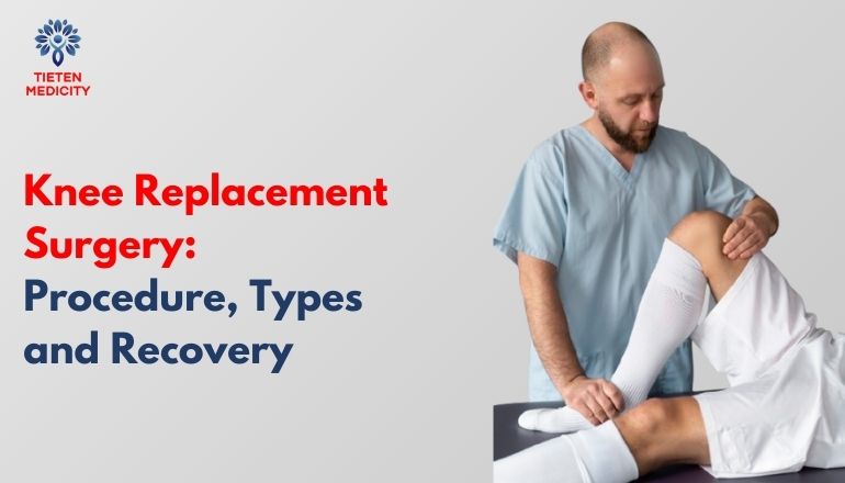 Knee Replacement Surgery: Procedure, Types and Recovery