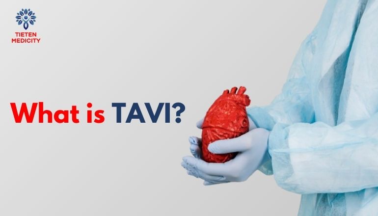 What is TAVI?