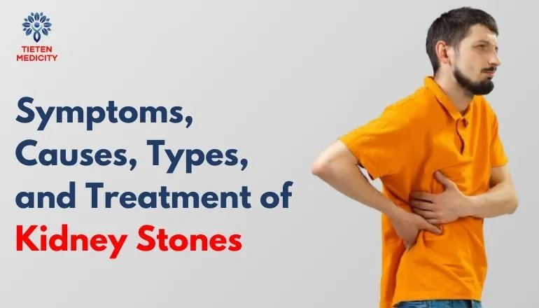 Symptoms, Causes, Types, and Treatment of Kidney Stones